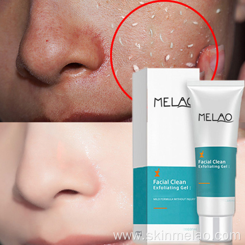Whitening Aloe Vera Exfoliating Gel Facial Wash Cleanser